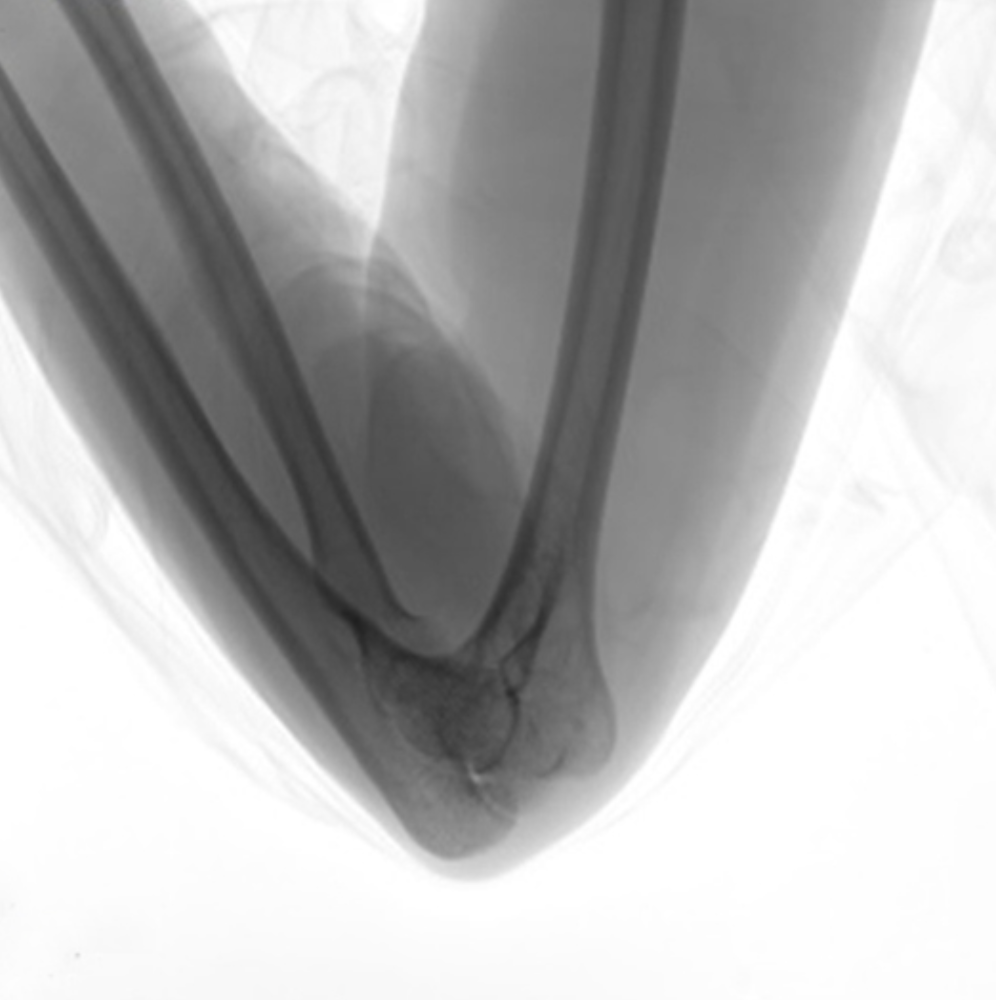 Oscar Prime Ramię C Radiologia Genoray TAG Medical