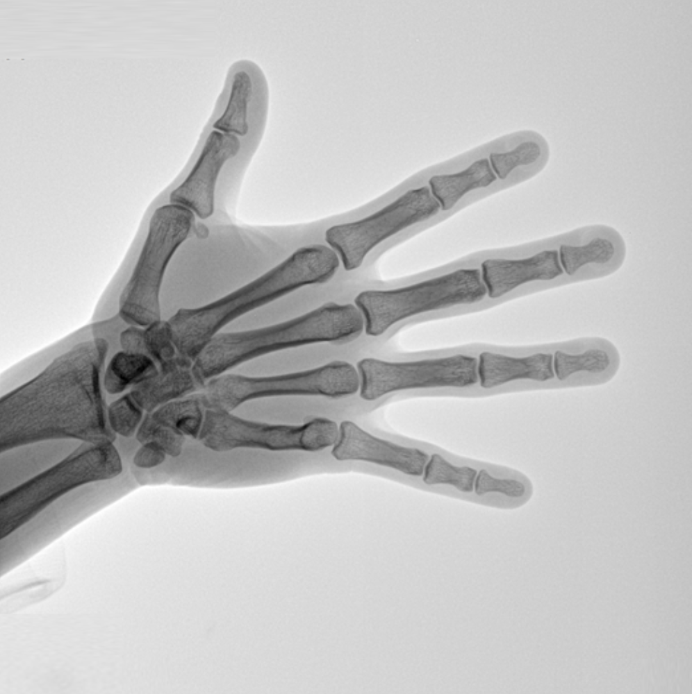 Oscar Prime Ramię C Radiologia Genoray TAG Medical