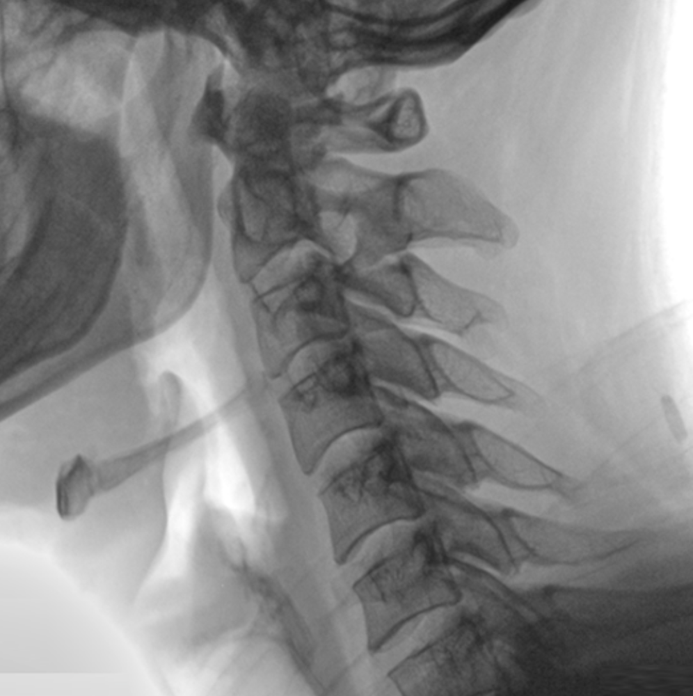 Oscar Prime Ramię C Radiologia Genoray TAG Medical