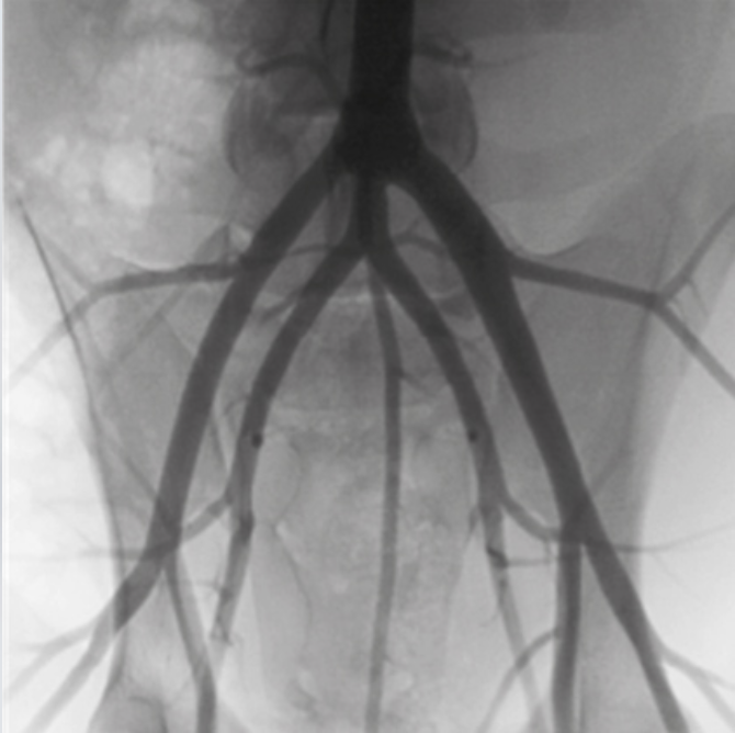 Oscar 15 Ramię typu C Radiologia TAG Medical