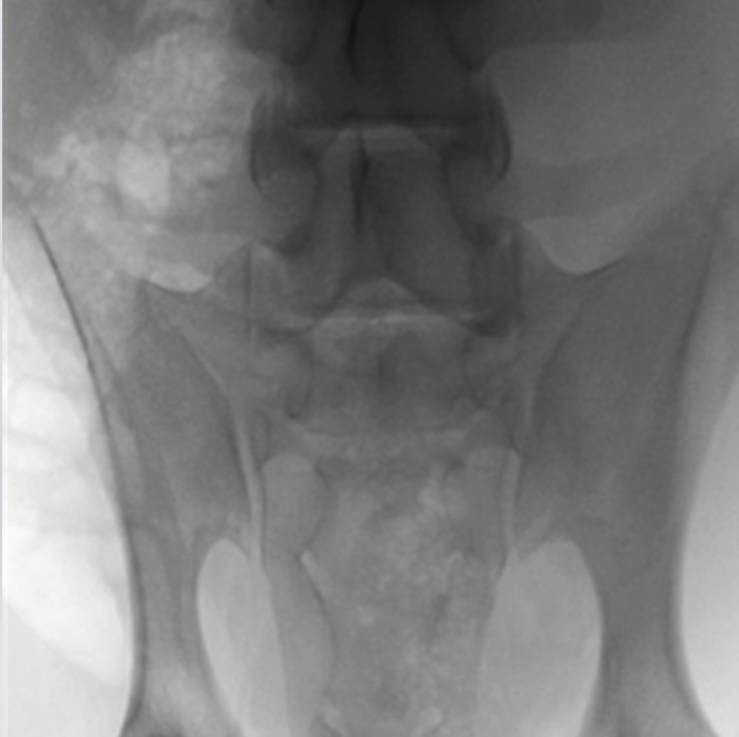 Oscar 15 Ramię typu C Radiologia TAG Medical
