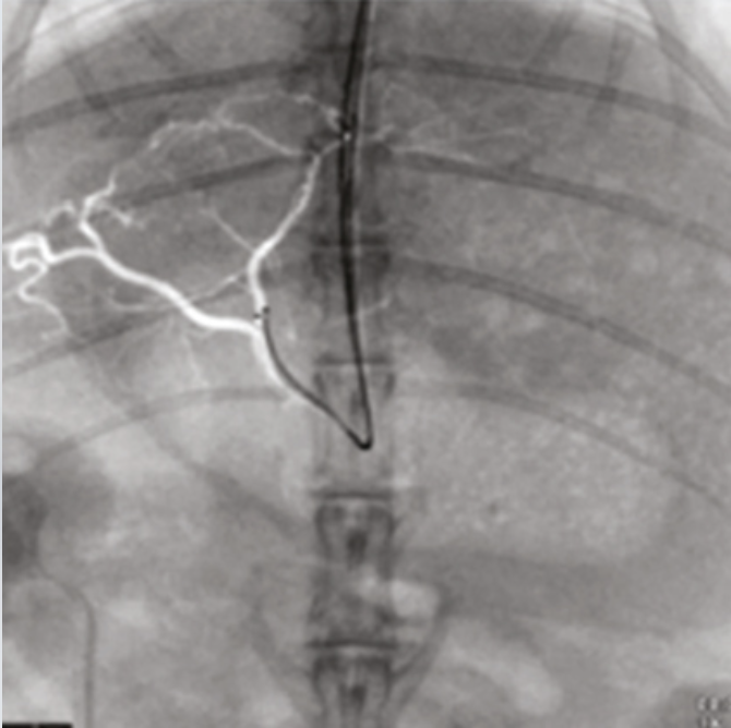 Oscar 15 Ramię typu C Radiologia TAG Medical
