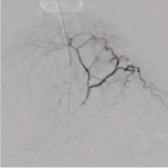 Oscar 15 Ramię typu C Radiologia TAG Medical