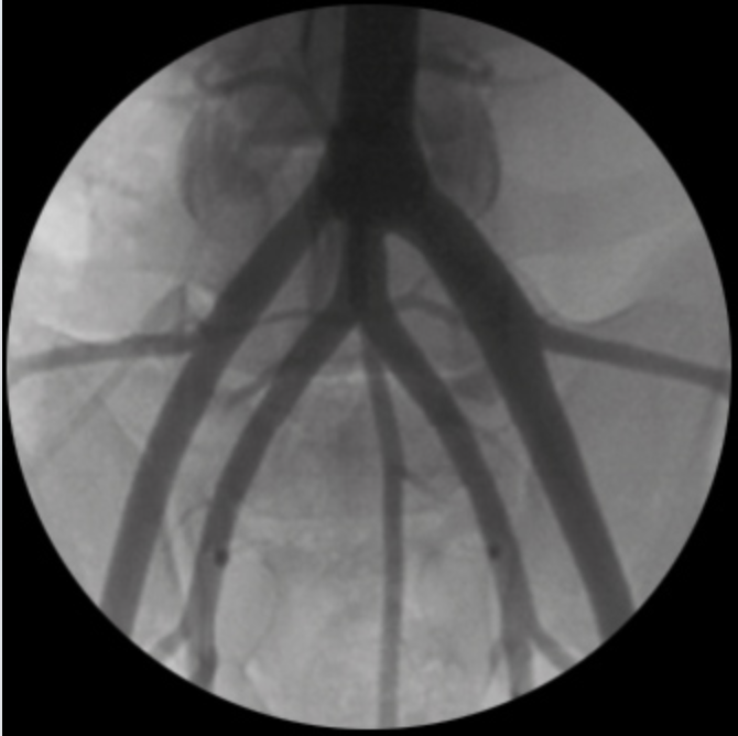 Oscar Classic Ramię typu C Radiologia TAG Medical