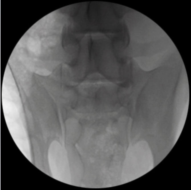 Oscar Classic Ramię typu C Radiologia TAG Medical