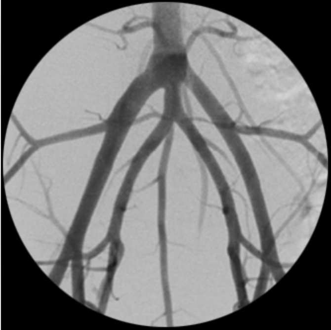 Oscar Classic Ramię typu C Radiologia TAG Medical