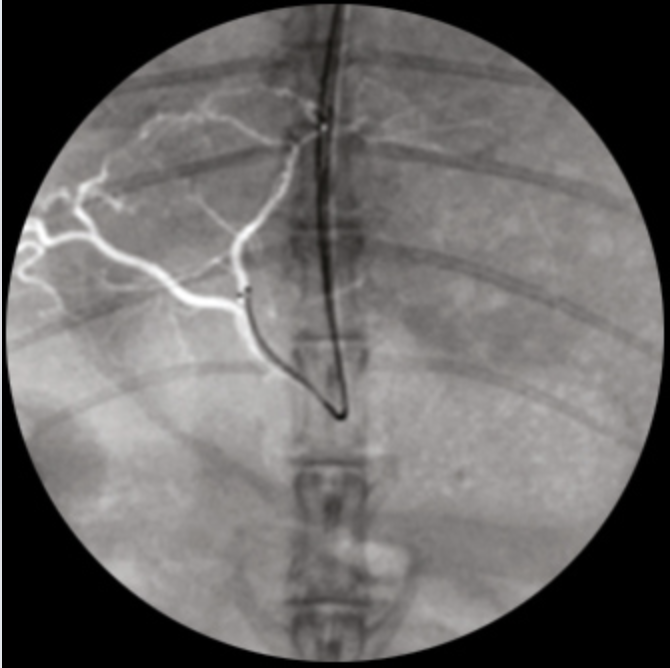 Oscar Classic Ramię typu C Radiologia TAG Medical