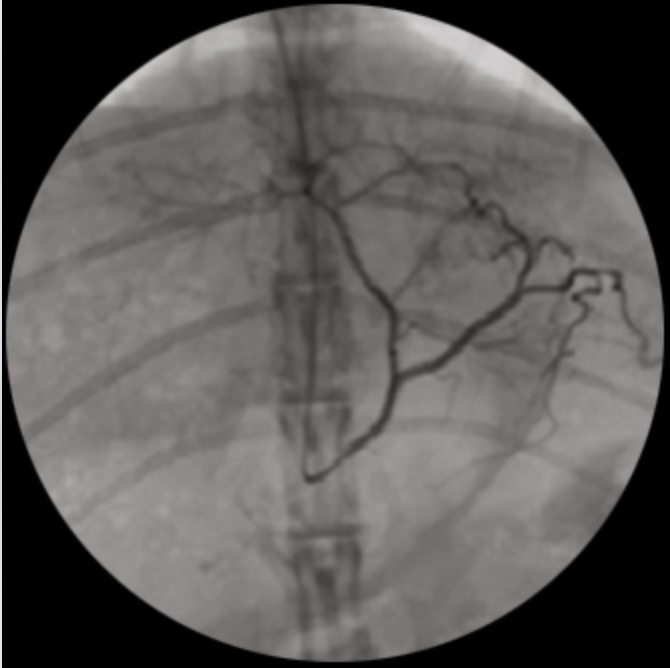 Oscar Classic Ramię typu C Radiologia TAG Medical