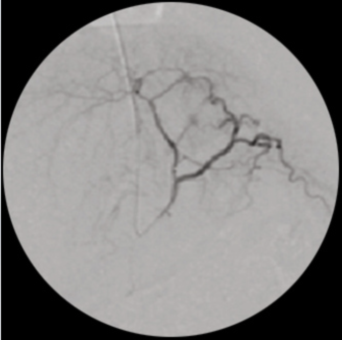 Oscar Classic Ramię typu C Radiologia TAG Medical