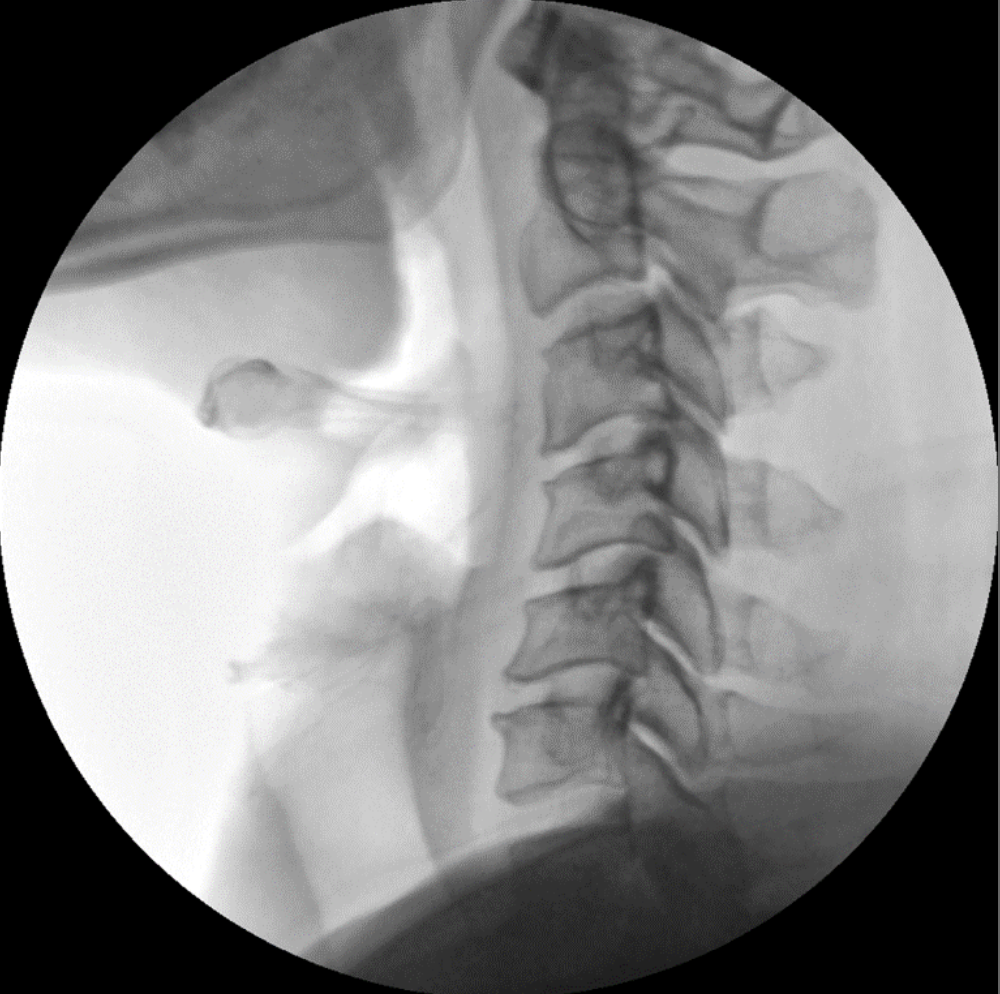 ZX 2090 Turbo Ramię typu C Radiologia Genoray TAG Medical