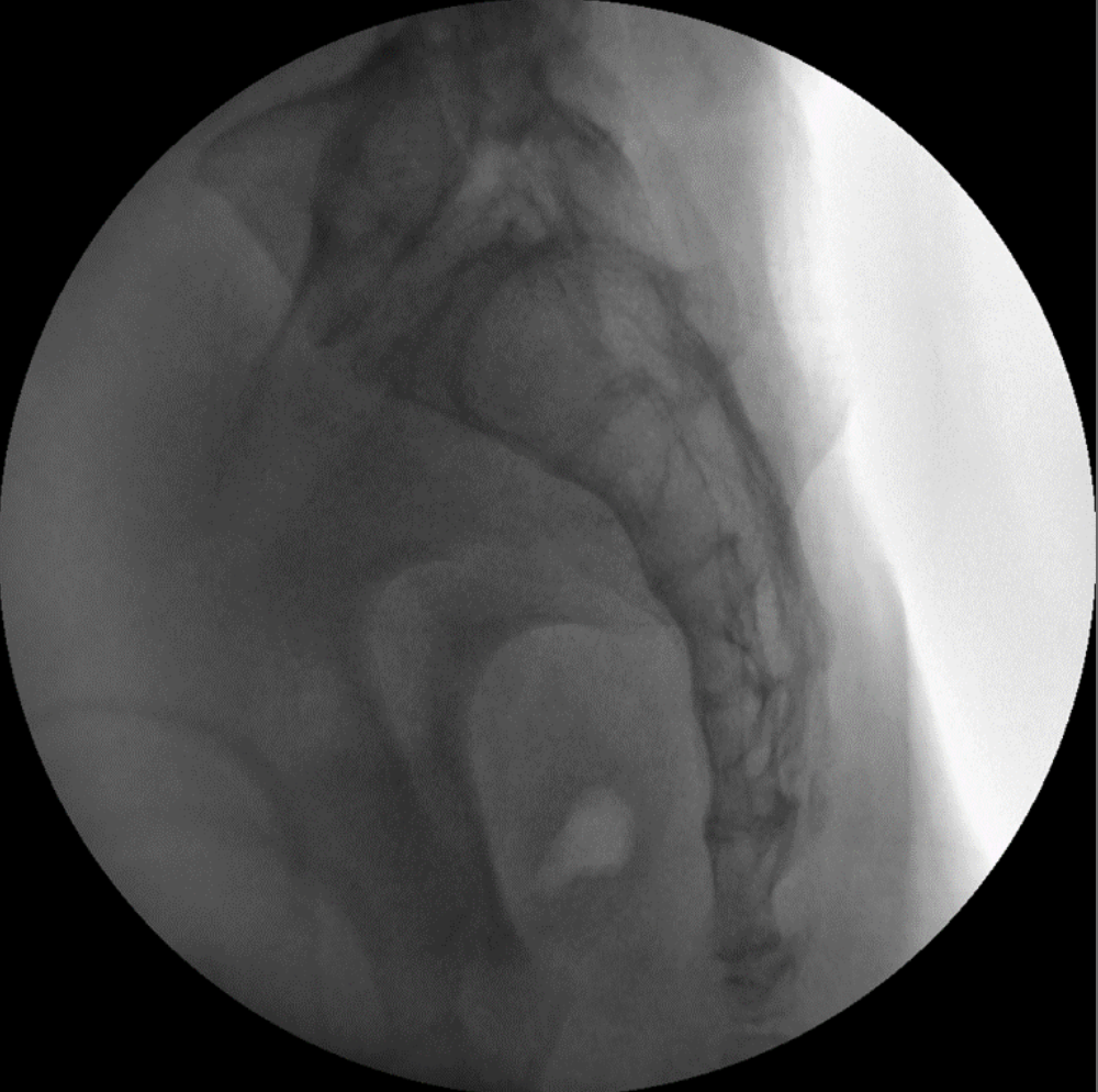 ZX 2090 Turbo Ramię typu C Radiologia Genoray TAG Medical