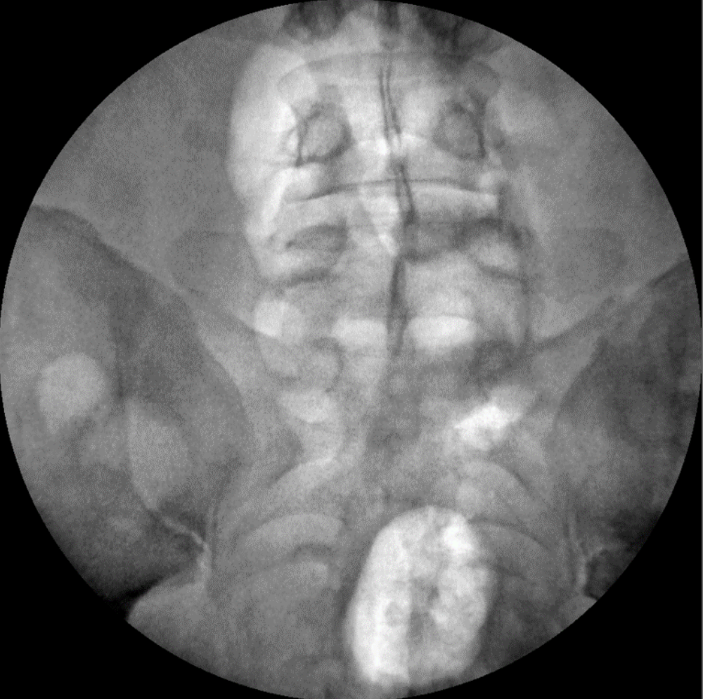 ZX 2090 Turbo Ramię typu C Radiologia Genoray TAG Medical