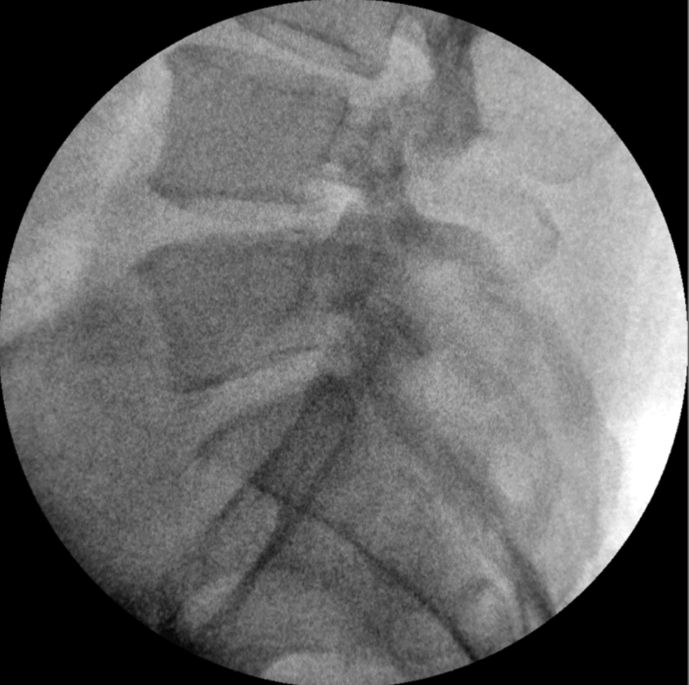 ZX 2090 Turbo Ramię typu C Radiologia Genoray TAG Medical