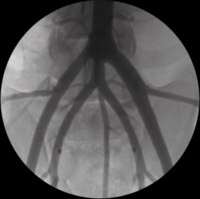 ZEN 7000 Ramię typu C Radiologia Genoray TAG Medical