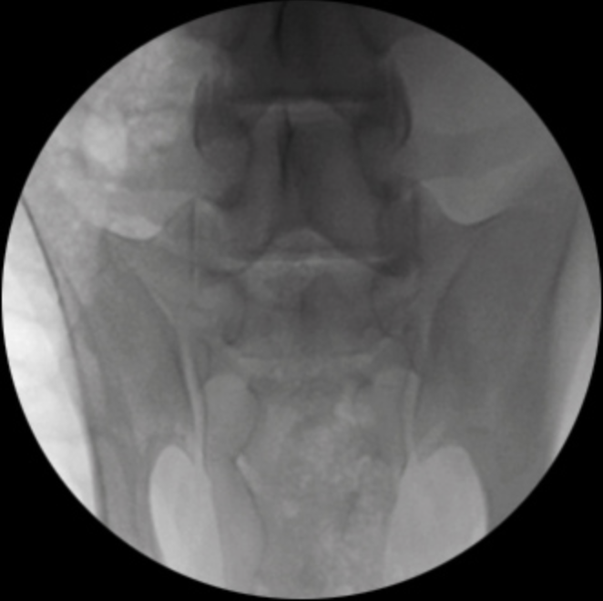 ZEN 7000 Ramię typu C Radiologia Genoray TAG Medical