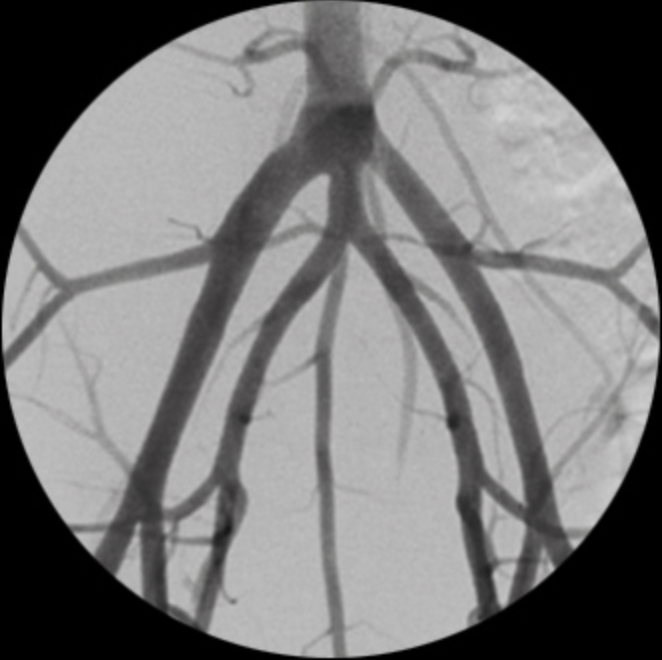 ZEN 7000 Ramię typu C Radiologia Genoray TAG Medical