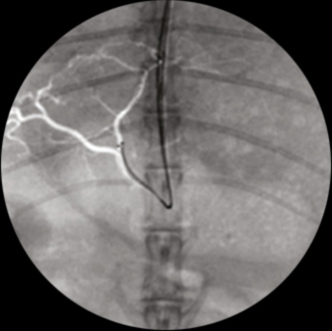 ZEN 7000 Ramię typu C Radiologia Genoray TAG Medical