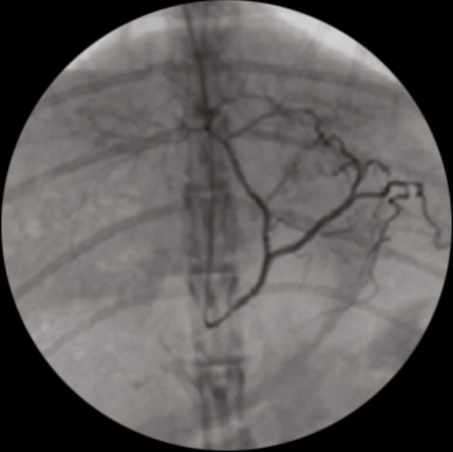 ZEN 7000 Ramię typu C Radiologia Genoray TAG Medical