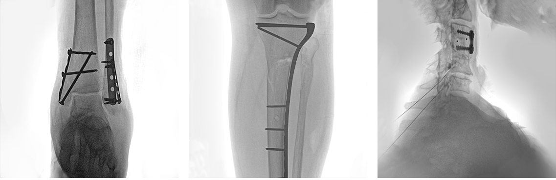 Bellinger Ace Radiologia General TAG Medical